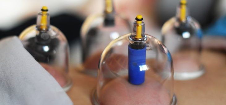 Cupping Thérapie : Médecine alternative pour la douleur, l’immunité et la digestion